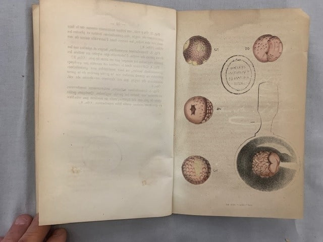 Amédée‎ Deville : Études Cliniques sur les Maladie Vénériennes. Da la Vaginite Granuleuse [avec dédicace de l'auteur]