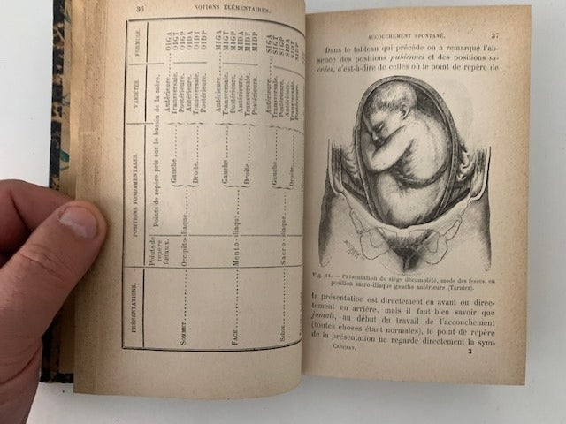 Crouzat‎ : Manoeuvres et Opérations à l'Amphithéatre. La pratique Obstetricale