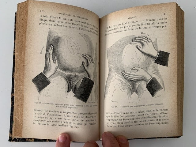 Crouzat‎ : Manoeuvres et Opérations à l'Amphithéatre. La pratique Obstetricale