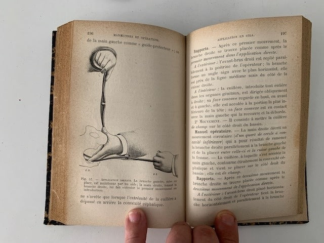 Crouzat‎ : Manoeuvres et Opérations à l'Amphithéatre. La pratique Obstetricale